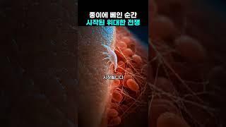 종이에 베인 순간, 벌어지는 일