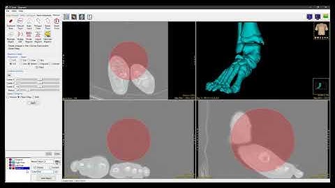 Analyze 14.0 - Segment: Fabricate Shapes
