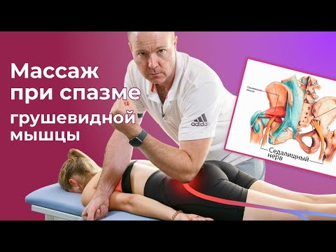 Синдром грушевидной мышцы. Массаж Седалищного нерва