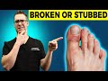 Stubbed Toe or Broken Toe?  [Symptoms, Pain Relief & Treatment!]