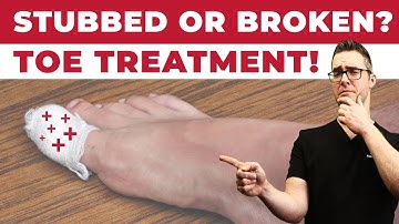 Stubbed Toe or Broken Toe?  [Symptoms, Pain Relief & Treatment!]