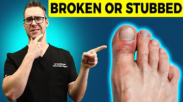 Stubbed Toe or Broken Toe?  [Symptoms, Pain Relief & Treatment!]