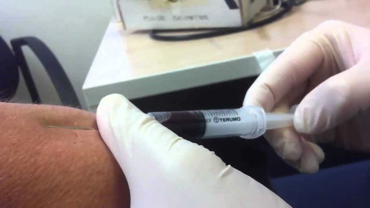 Blood Test Time YouTube