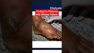 Caring for Patients with Kidney Disease