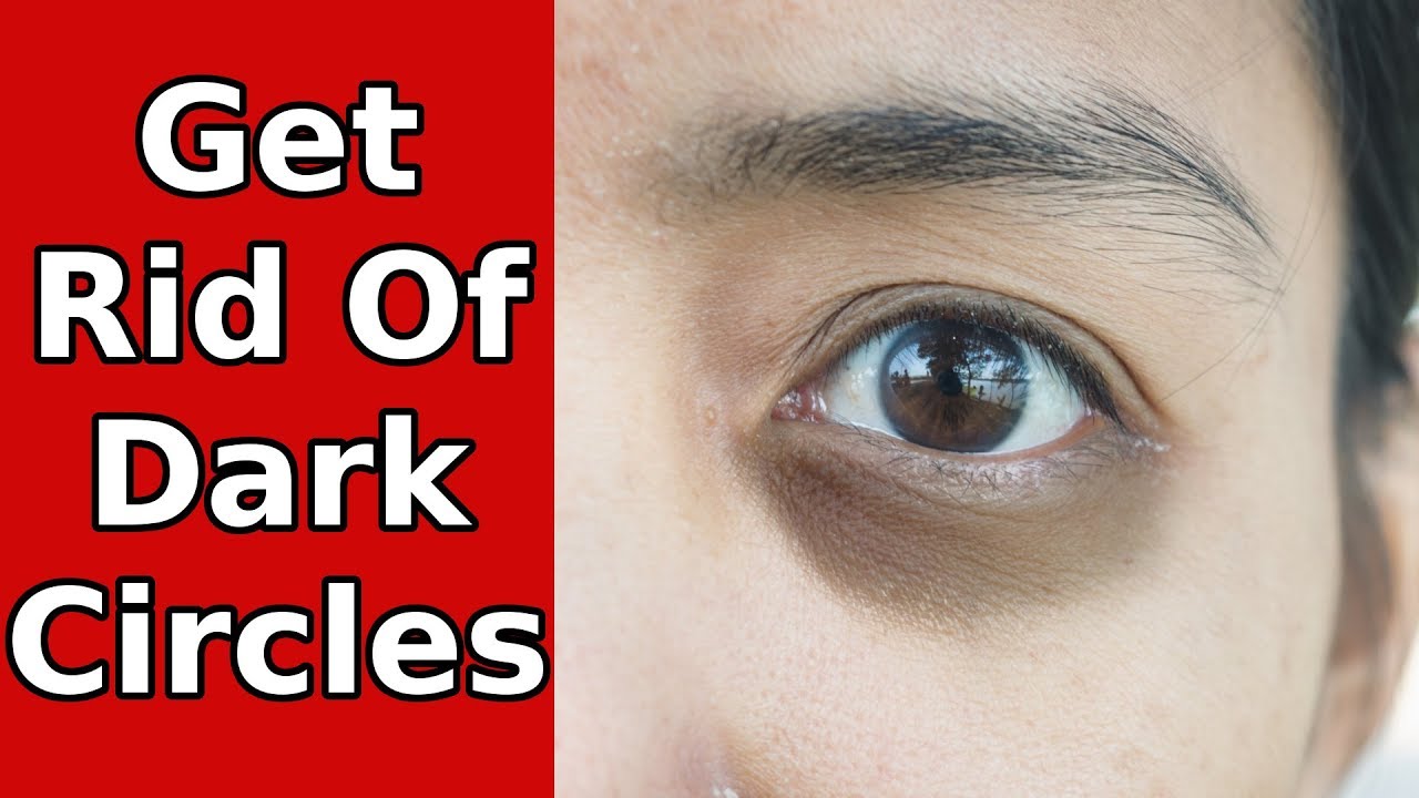 3 Unusual Home Remedies For Dark Circles Around Eyes YouTube