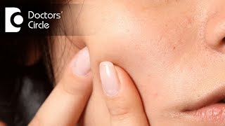 What can cause painful lump on cheek? - Dr. Srivats Bharadwaj