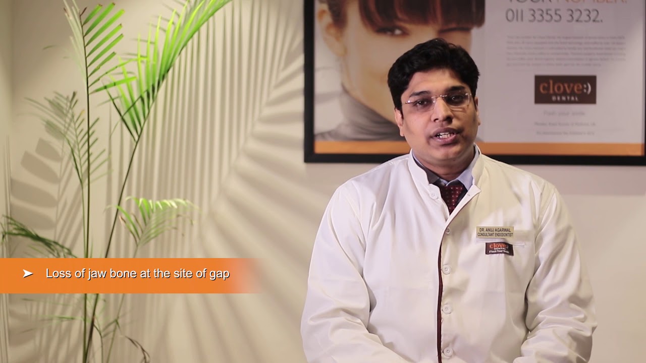 Consequences of not replacing Missing Teeth - Dr. Anuj Agrawal