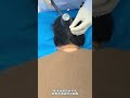 Insomnia dizziness headache sympathetic cervical spondylosis combined with bone setting an