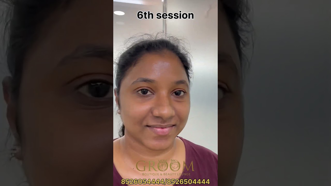 Skin Lightening Treatment ✨❤️