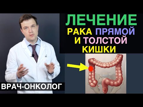 Рак толстой кишки лечение рака толстой кишки и рака прямой кишки