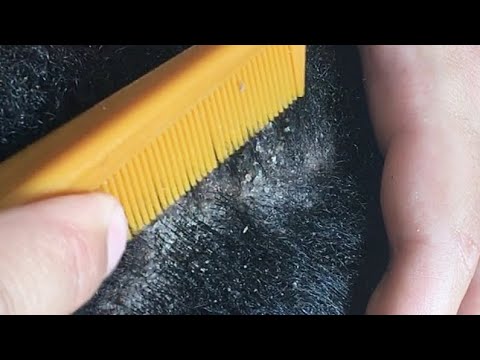 [ASMR] Scratching Flakes & Blowing / Huge Tingles [HD]