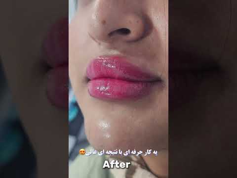 لب فلت و جذاب