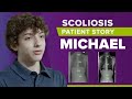 Moderate Scoliosis Treatment Without Surgery: Michael&#39;s Story
