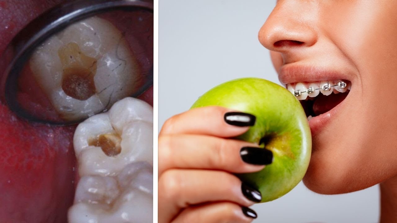 These 3 Fruits Can Fix Most of Your Gum and Teeth Issues - YouTube
