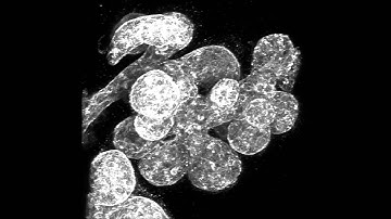 Perturbation-Expression Analysis Identifies RUNX1 as a Regulator of Human Mammary Stem Cell...