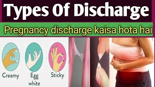 Pregnancy Discharge है या Periods आने से पहले का discharge हैं इस आसान तरीके से समझ सकते है screenshot 1