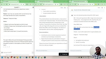 Llama-3 vs ChatGPT4 in Medical Report Generation