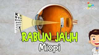 IPA FISIKA : Cacat Mata Miopi atau Rabun Jauh (Simulasi Alat Optik Kacamata Lensa Cekung)