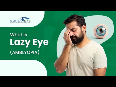 Lazy Eye ( Amblyopia ): The Hidden Vision Problem | Explained by Dr. Jay Goyal