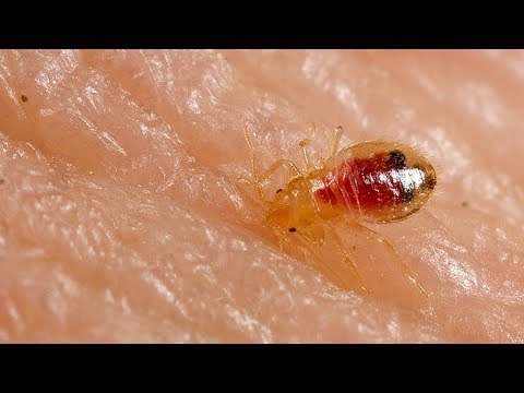 Video: Das ekelhafteste heimische Insekt: Wanzen, Kakerlaken, Spinnen, Ameisen. Methoden der Kontrolle und Prävention
