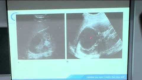 Chuyên đề hình ảnh nhiễm khuẩn tiết niệu (phần giảng thầy Thảo)