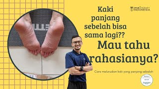 Terapi Kaki Panjang Sebelah - Uneven Hip Unbelievable Transformation