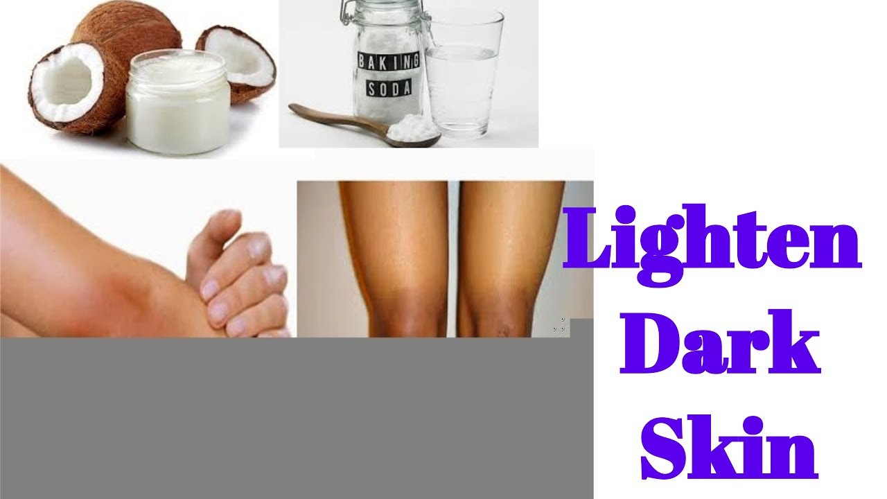 Skin Whitening For Dark Knees & Dark Elbows How to Get Rid of Dark