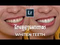 How to Whiten Teeth in Adobe Photoshop Lightroom Classic CC (Quick &amp; Easy)