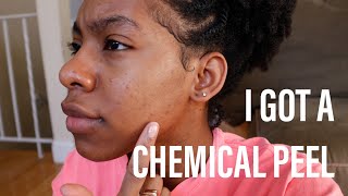 I GOT A CHEMICAL PEEL I ACNE SCARS &amp; HYPERPIGMENTATION I @IAMTIFFANI