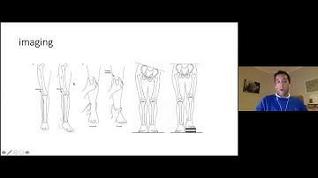 Principles of deformity correction for the FRCS
