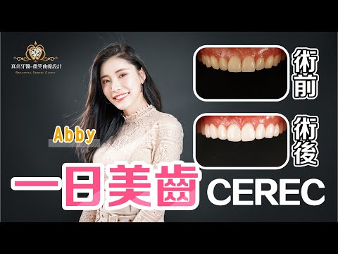 【牙齒美白 微笑曲線設計】真美之星-DJ Abby │ 新竹真美牙醫診所