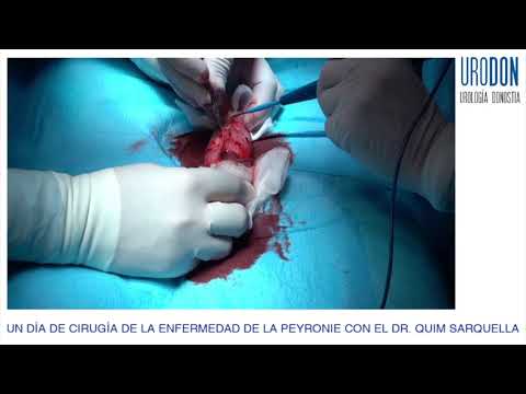 Peyronie Plastia Tachosil Dr. Sarquella. Dr. Garmendia