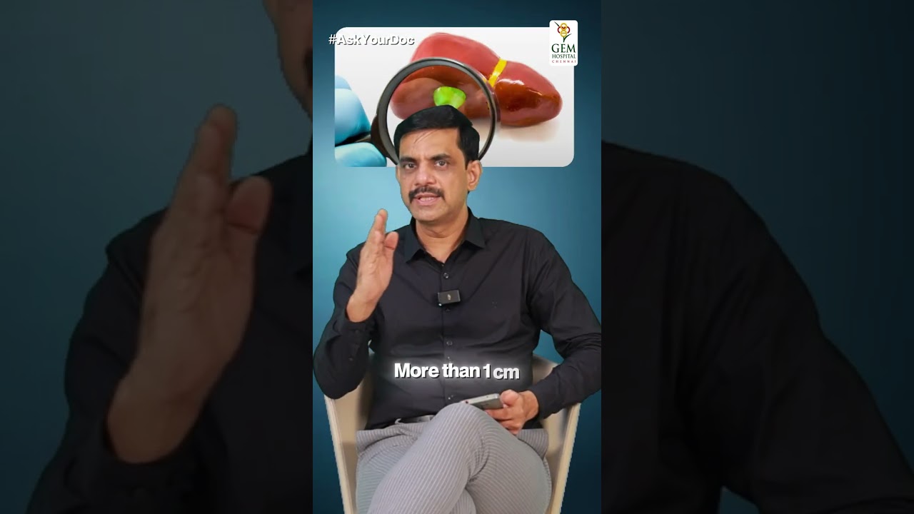 Understanding Gallbladder Polyps: Observation vs. Surgical Removal