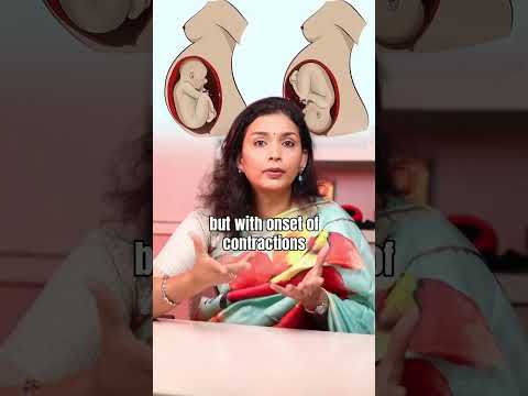 Kanaa Fertility Short 6