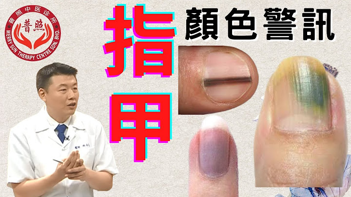 指甲的颜色警讯 | 指甲出现黑线条或变成青赤黄白黑的颜色，提示什么样的身体状况呢? | 黑色素细胞瘤