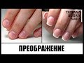 Ногти Грызуна/ Преображение Проблемных Ногтей/ Женственный Маникюр/ Наращивание на обкусышах