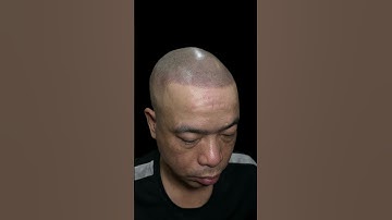 Diệu kỳ xăm tóc tại vnscalp thay đổi ngoại hình với xăm tóc #xămtóc #hói_đầu #scalp #xămchântóc