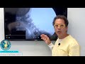 Why disc replacement surgery may not resolve pain and other issues