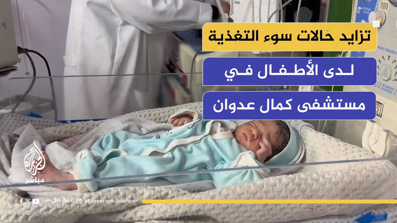 تزايد حالات سوء التغذية لدى الأطفال في كمال عدوان يستدعي علاجًا فوريًا