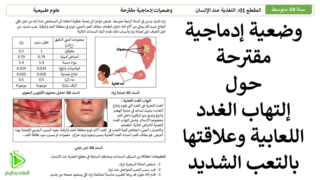 وضعية إدماجية مقترحة لشهادة التعليم المتوسط BEM إلتهاب الغدد اللعابية والتعب الشديد علوم طبيعية