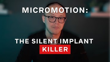 Micromotion: The Silent Implant Killer (All-on-X, All-on-4, FP1/FP3 & Anterior Implants)