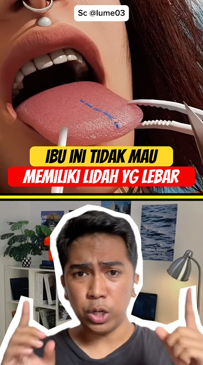 This Mother Didn't Want to Have a Wide Tongue So She Had It Operated On #feedshorts #shortsviral ...