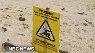 Bacteria shuts down beaches coast to coast in the U.S.