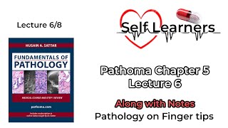 Chapter 5/Normocytic anemia:Paroxysmal nocturnal Hemoglobinuria&amp;G6PD deficiency/Pathoma