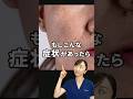【肝斑】まず試すべき成分を皮膚科医が解説