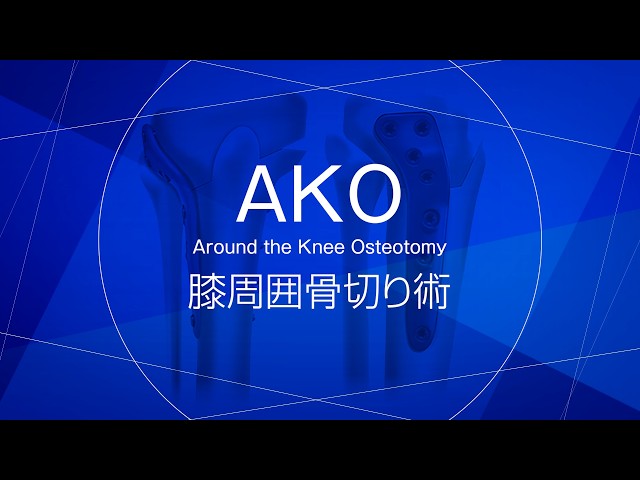 整形外科専門医 榊原醸様「AKO膝周囲骨切り術 手術説明」 - YouTube