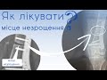 Як лікувати перелом, який не зростається ?