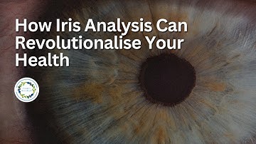 How Iris Analysis Can Revolutionalise Your Health