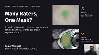 Many Raters, One Mask A Tutorial on Consensus Aggregation for Medical Image Segmentation
