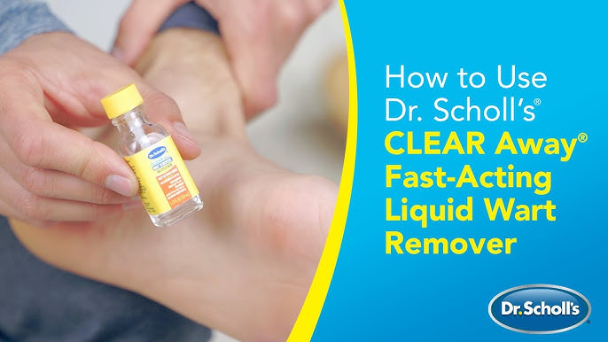 Dr. Scholl's  Freeze Away® Skin Tag Remover 